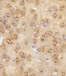 NSF Antibody